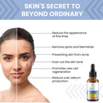 Applying the 1% Retinol Serum on face for acne-control and smoother skin