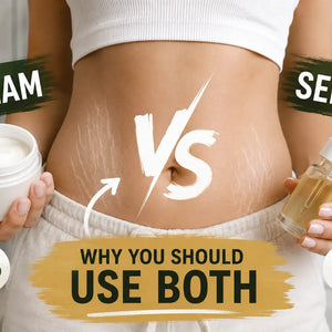 Cream vs Serum for Stretch Marks: Why You Should Use Both