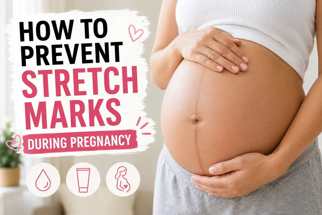 How to Prevent Stretch Marks During Pregnancy
