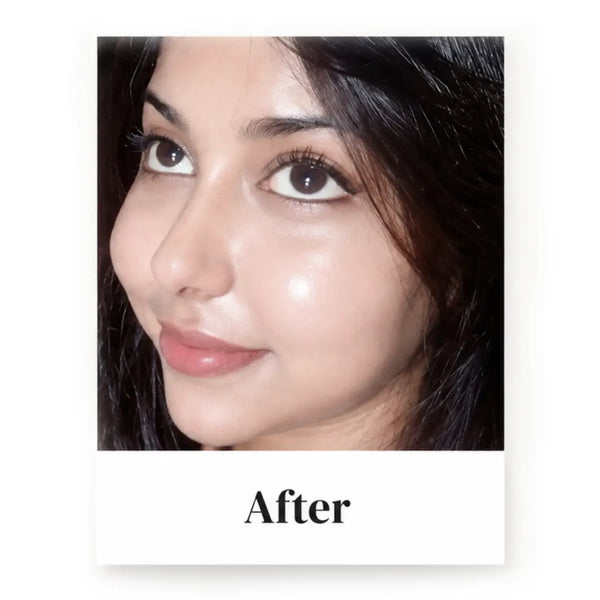 After transformation