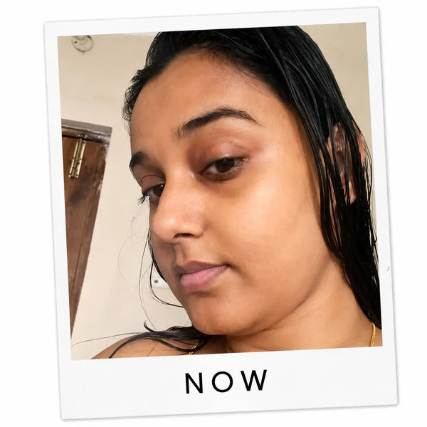 After transformation