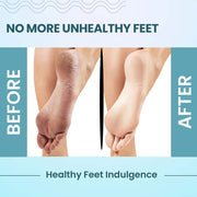 Foot Care Cream for Cracked Heels & Rough Feet