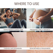 Lass Natural Stretch Mark Care Roll-On Serum with Striover™ – 50 ml