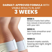 Lass Natural Stretch Mark Care Roll-On Serum with Striover™ – 50 ml