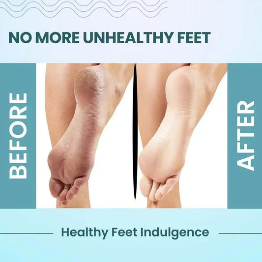 Foot Care Cream for Cracked Heels & Rough Feet – Deep Repair & Soothing Relief
