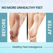 Foot Care Cream for Cracked Heels & Rough Feet – Deep Repair & Soothing Relief