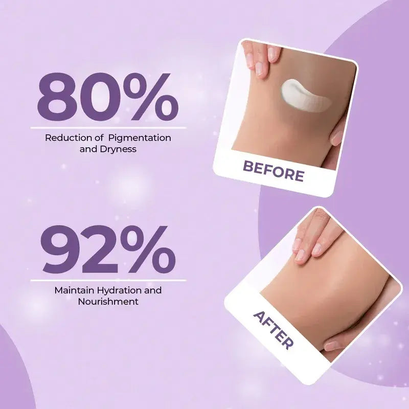 Elbow & Knee Lightening Cream for Pigmentation, Rough Texture & Dull Skin – 50 g