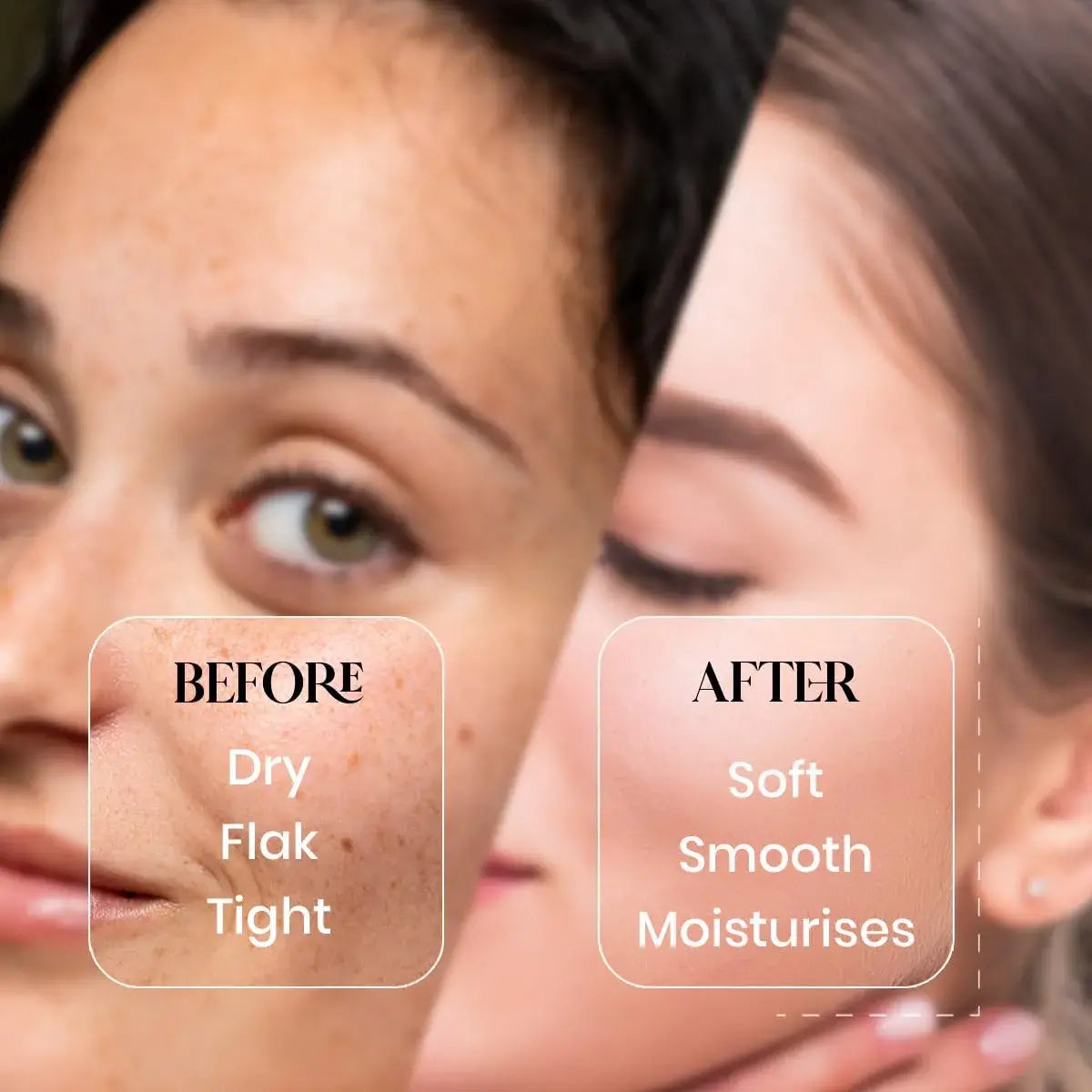 Lass Natural Vitamin E Moisturising Lotion For Dry To Combination, Sensitive Skin|Non Greasy | Deep Moisturization-300ml