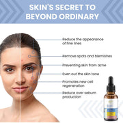 Applying the 1% Retinol Serum on face for acne-control and smoother skin

